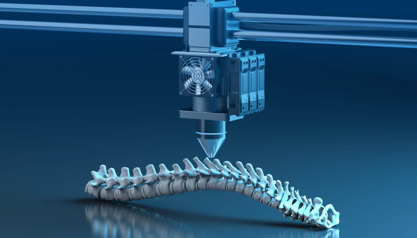 Stampa 3D medicale - Centro Medica Cinisi - poliambulatorio e diagnostica per immagini